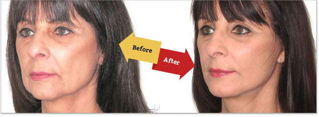 Illustration for article titled Face Lift in Islamabad